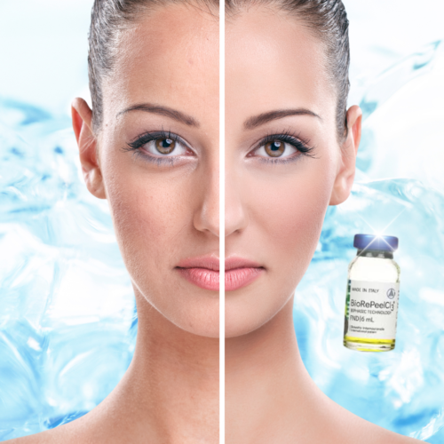 CELLULAR REGENERATION-FACE Peeling chimic BioRePeel® Cl3