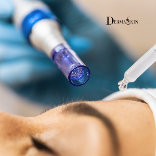DERMAPEN PRO Microneedling - regenerare celulară prin inducție de colagen și elastină