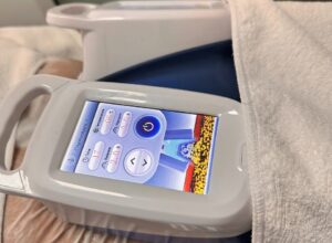 Criolipoliza pentru abdomen