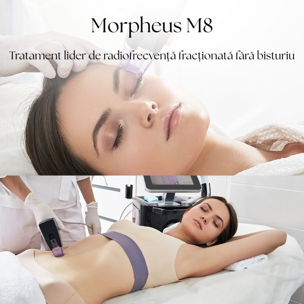 Morpheus M8 Galați Radiofrecvență Fracționată DermaSkin Galați Remodelare cutanată cu radiofrecvență