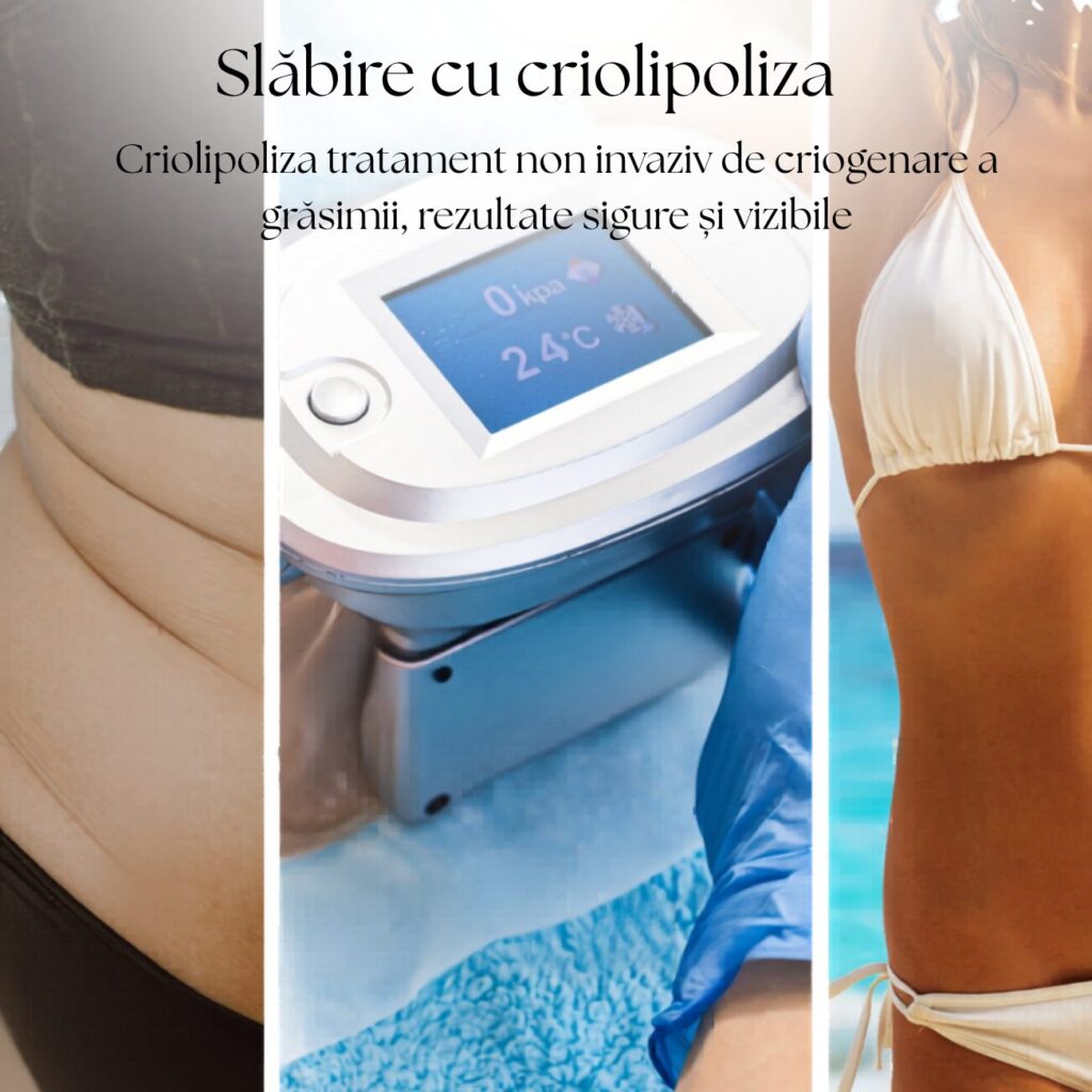 Tratament criolipoliză abdomen la centru DermaSkin Galați