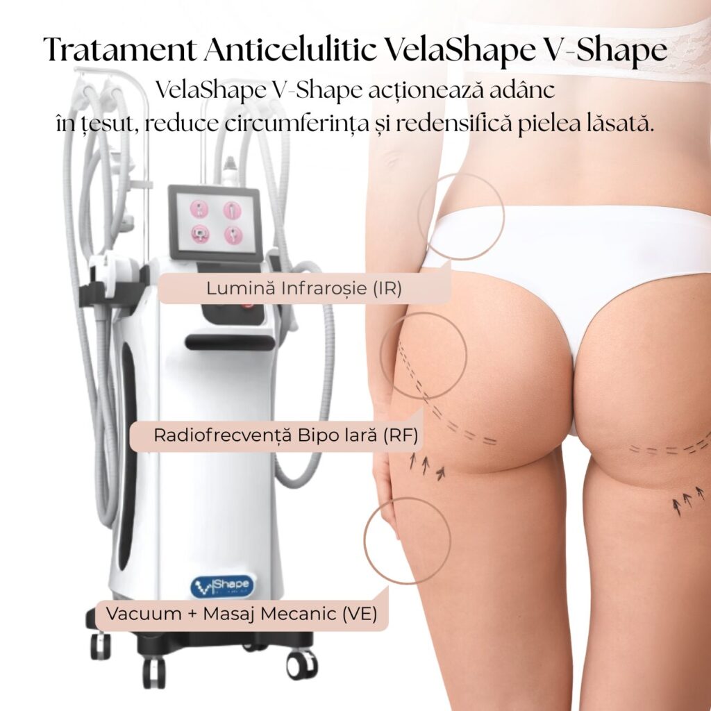 tratament anticelulitic Galați DermaSkin