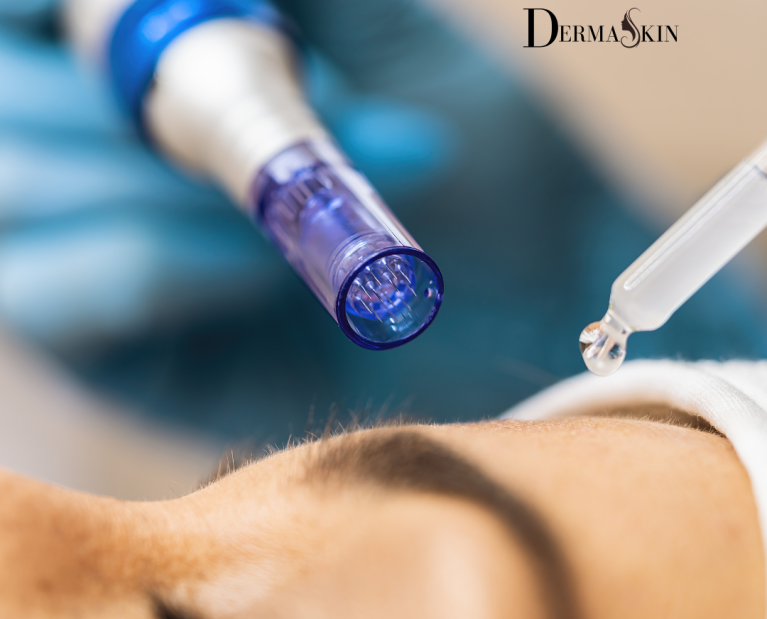 DERMAPEN PRO Microneedling - regenerare celulară prin inducție de colagen și elastină