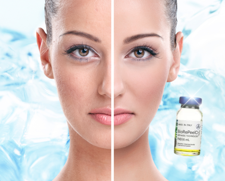 CELLULAR REGENERATION-FACE Peeling chimic BioRePeel® Cl3